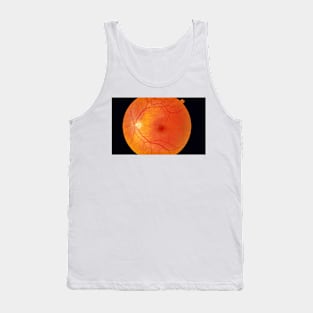 Healthy retina (P424/0175) Tank Top